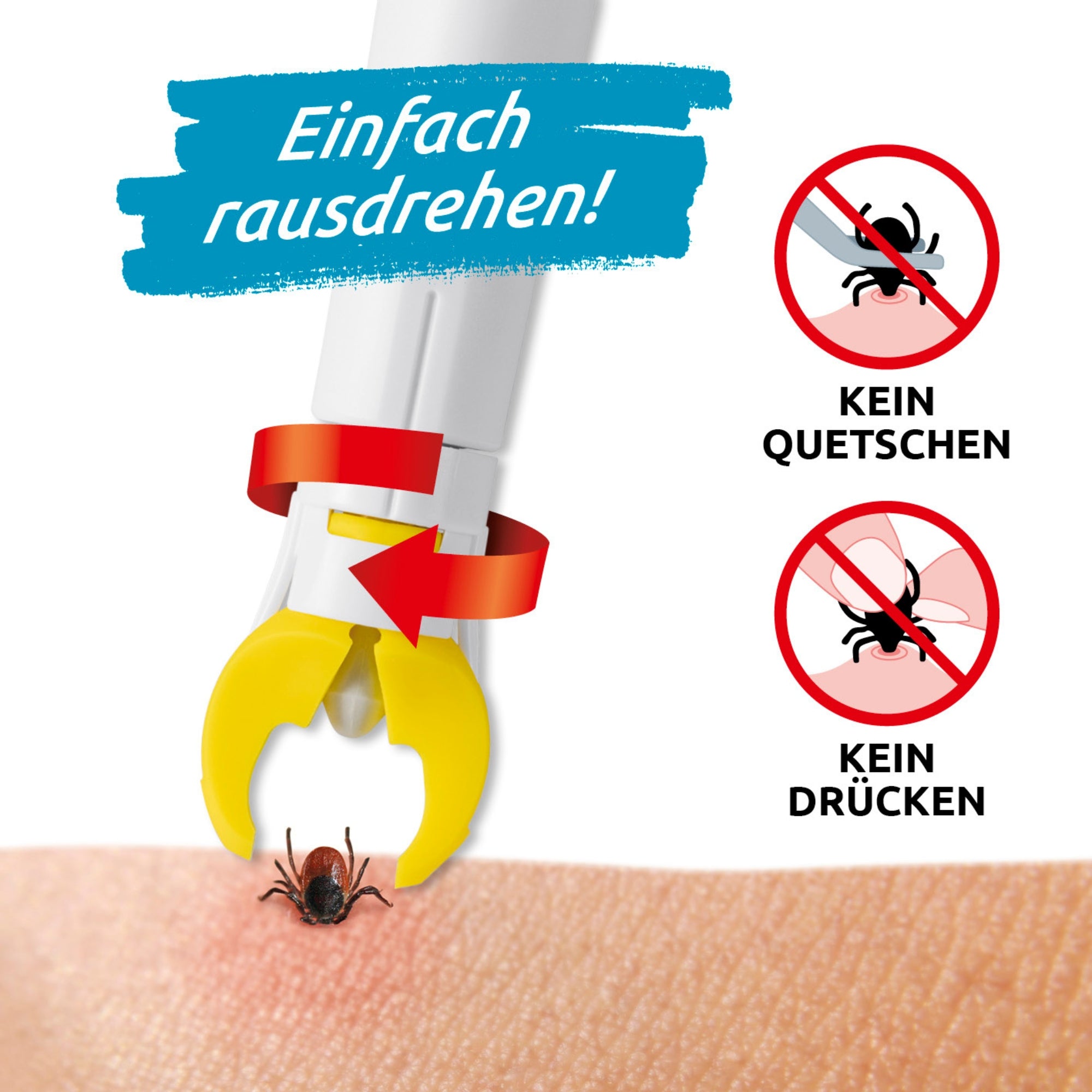 Auf einem Stück Haut (Arm) hat sich eine Zecke verhakt und es wird versucht die se mit einer Zeckenzange heraus zu drehen. Neben dem Schaubild sind Bilder mit Zecken zu sehen wo drunter steht "Kein quetschen" und "Kein drücken".